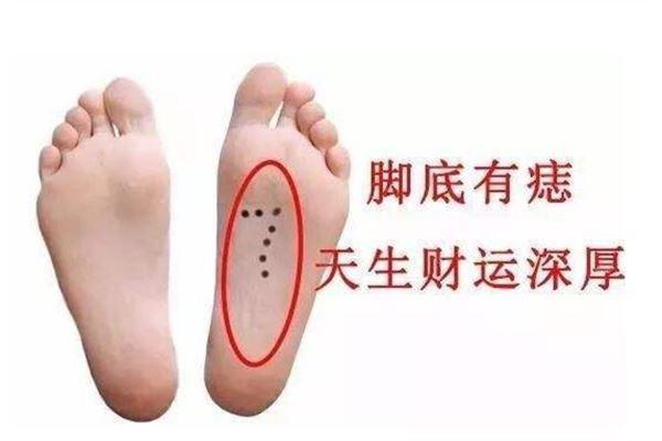 脚下有痣代表什么