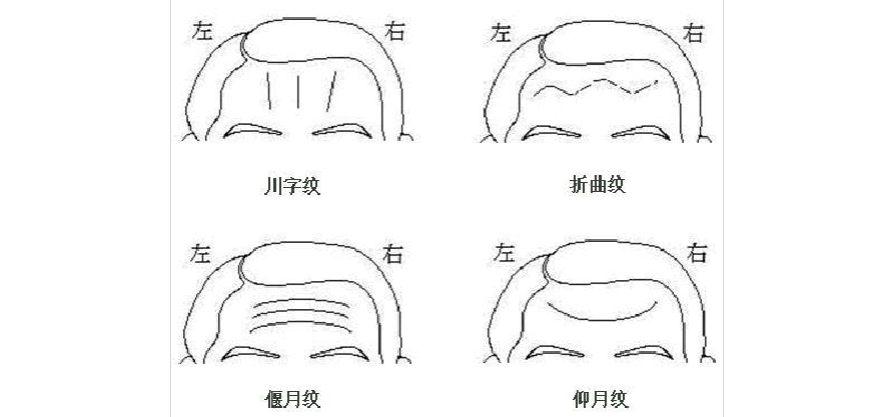 文化/宗教 > 额头上的皱纹带给你的命运提示核心提示:在面相中,额头是