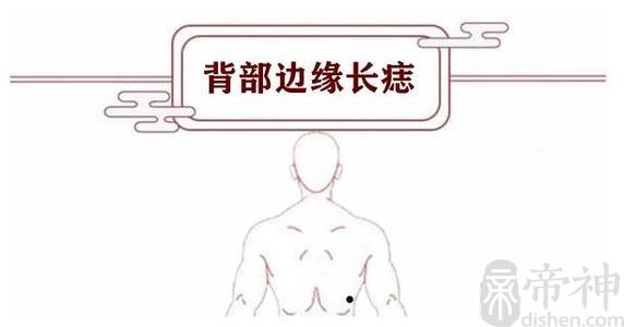 背上长痣图解 背上长痣有何含义-帝神算命网手机版